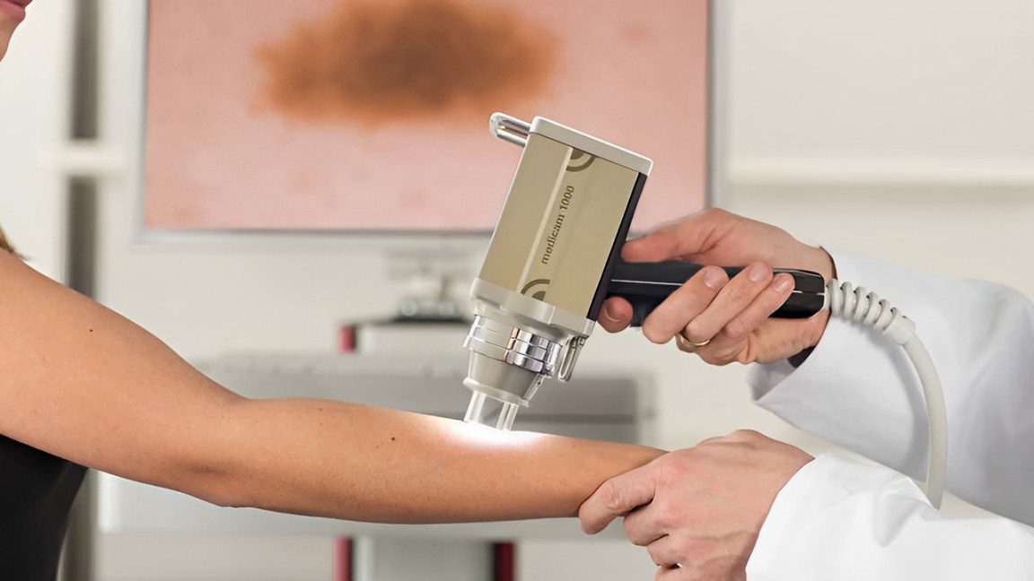 Exame preventivo para avaliação de pintas e risco de melanomas.